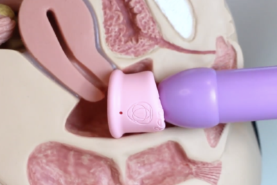 como usar la copa menstrual para tener sexo